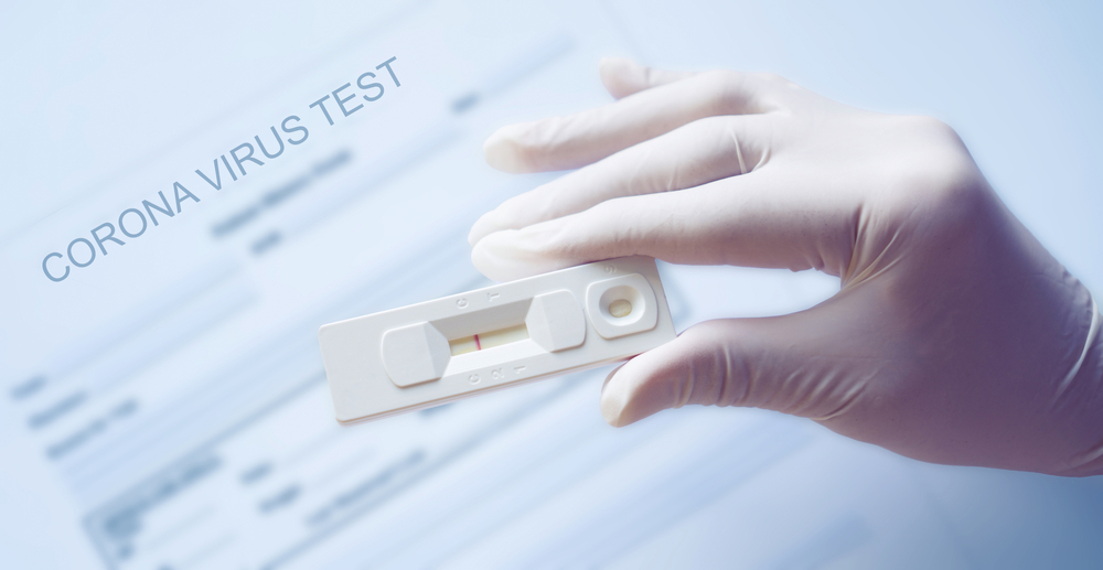 Apa Perbedaan Rapid Test Vs PCR Test Untuk Deteksi COVID-19?